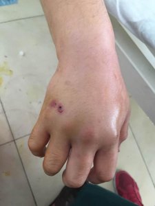 蛇在什么情况下会咬人 蛇何时会攻击人类